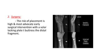 Fracture of the distal radius | PPTX
