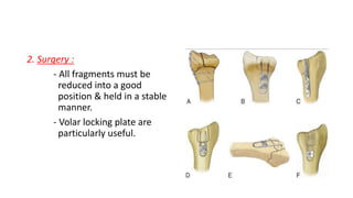 Fracture of the distal radius | PPTX