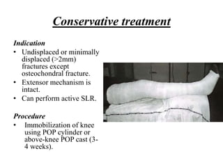 FRACTURE OF THE PATELLA.pptx