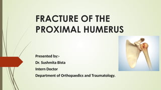 Comprehensive Overview of Proximal Humerus Fracture: Diagnosis and ...