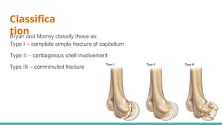 Fracture of Upper Limb Part 2 097826.pptx