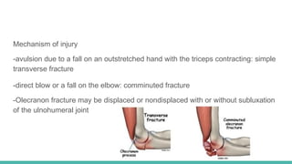 Fracture of Upper Limb Part 2 097826.pptx