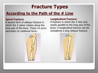 Spiral Fracture
A severe form of oblique fracture in
which the # plane rotates along the
long axis of the bone. These #s occur
secondary to rotational force.
Longitudinal Fracture
A fracture in which the # line runs
nearly parallel to the long axis of the
bone. A longitudinal fracture can be
considered a long oblique fracture.
According to the Path of the # Line
Fracture Types
 