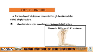 fracture ppt.pptx