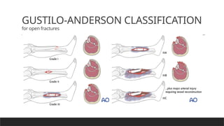 Anderson Classification Basic anatomy of Bone , Fracture and Healing | PPTX