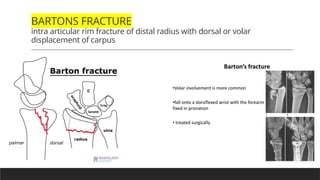 Basic anatomy of Bone , Fracture and Healing | PPTX