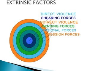 COMPRESSION FORCES
TORSIONAL FORCES
BENDING FORCES
INDIRECT VIOLENCE
SHEARING FORCES
DIRECT VIOLENCE
 