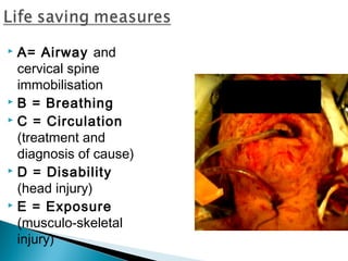  A= Airway and
cervical spine
immobilisation
 B = Breathing
 C = Circulation
(treatment and
diagnosis of cause)
 D = Disability
(head injury)
 E = Exposure
(musculo-skeletal
injury)
 