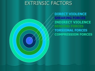 EXTRINSIC FACTORS
COMPRESSION FORCES
TORSIONAL FORCES
BENDING FORCES
INDIRECT VIOLENCE
SHEARING FORCES
DIRECT VIOLENCE
 