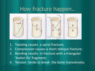 How fracture happen..
1. Twisting causes a spiral fracture;
2. Compression causes a short oblique fracture;
3. Bending results in fracture with a triangular
'butter-fly‘ fragment;
4. Tension tends to break the bone transversely;
 