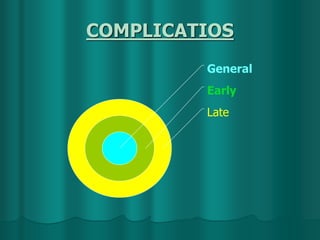 COMPLICATIOS
Late
Early
General
 