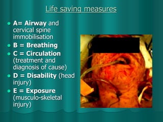 Life saving measures
 A= Airway and
cervical spine
immobilisation
 B = Breathing
 C = Circulation
(treatment and
diagnosis of cause)
 D = Disability (head
injury)
 E = Exposure
(musculo-skeletal
injury)
 