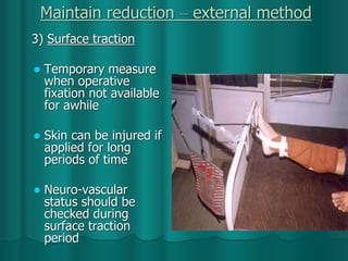 Maintain reduction – external method
3) Surface traction
 Temporary measure
when operative
fixation not available
for awhile
 Skin can be injured if
applied for long
periods of time
 Neuro-vascular
status should be
checked during
surface traction
period
 