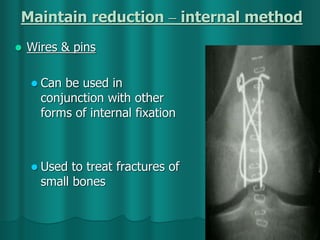 Maintain reduction – internal method
 Wires & pins
 Can be used in
conjunction with other
forms of internal fixation
 Used to treat fractures of
small bones
 