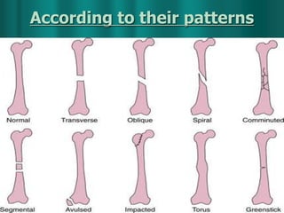According to their patterns
 