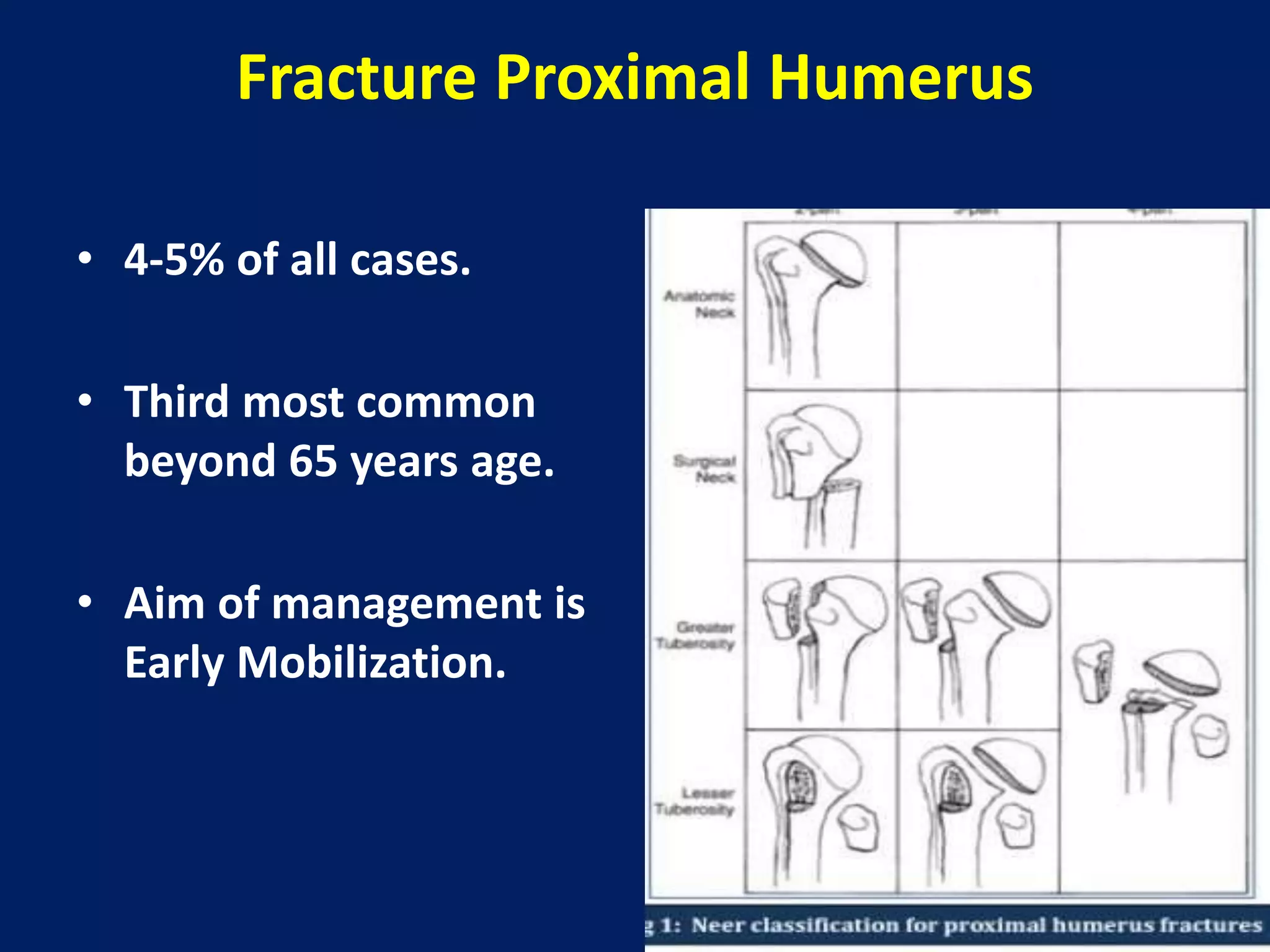 Fracture proximal humerus | PPTX
