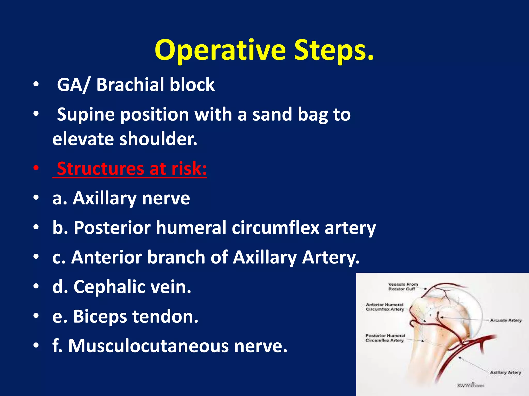 Operative Steps.
• GA/ Brachial block
• Supine position with a sand bag to
elevate shoulder.
• Structures at risk:
• a. Axillary nerve
• b. Posterior humeral circumflex artery
• c. Anterior branch of Axillary Artery.
• d. Cephalic vein.
• e. Biceps tendon.
• f. Musculocutaneous nerve.
 