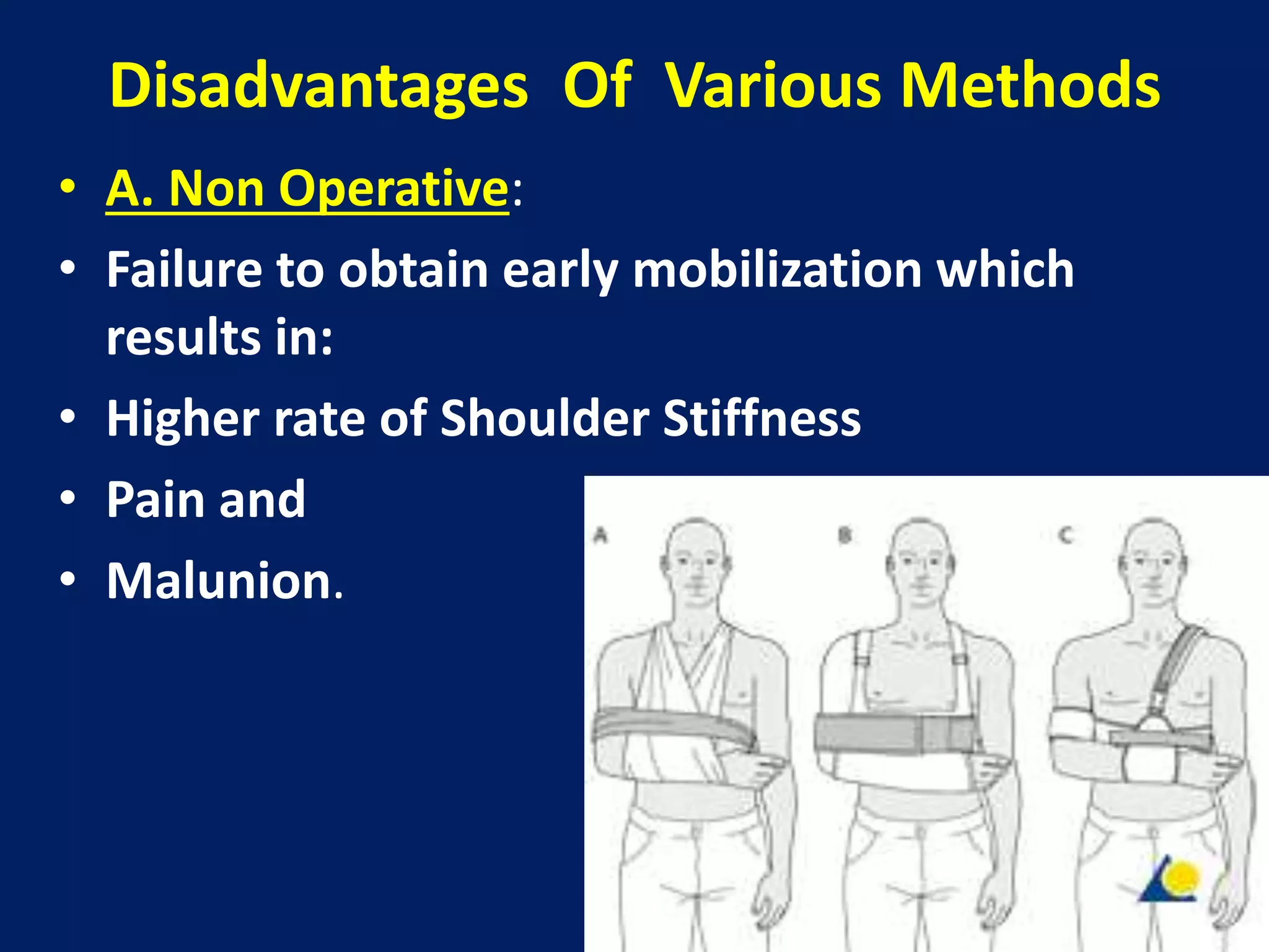Disadvantages Of Various Methods
• A. Non Operative:
• Failure to obtain early mobilization which
results in:
• Higher rate of Shoulder Stiffness
• Pain and
• Malunion.
 