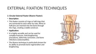 FRACTURE REDUCTION AND IMMOBILIZATION.pptx