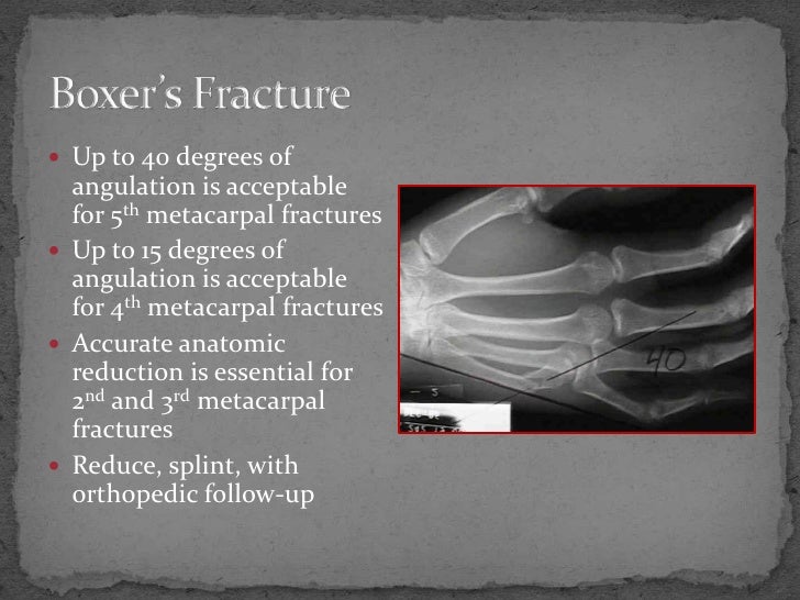 Fracture Review New Format