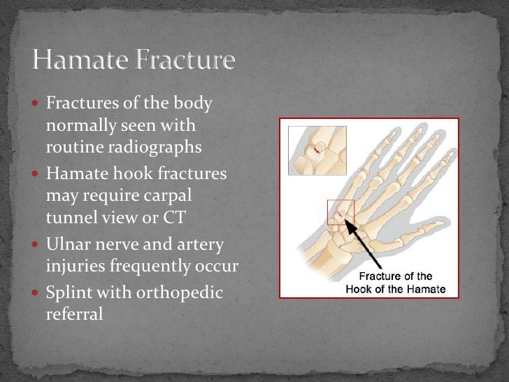 Fracture Review New Format