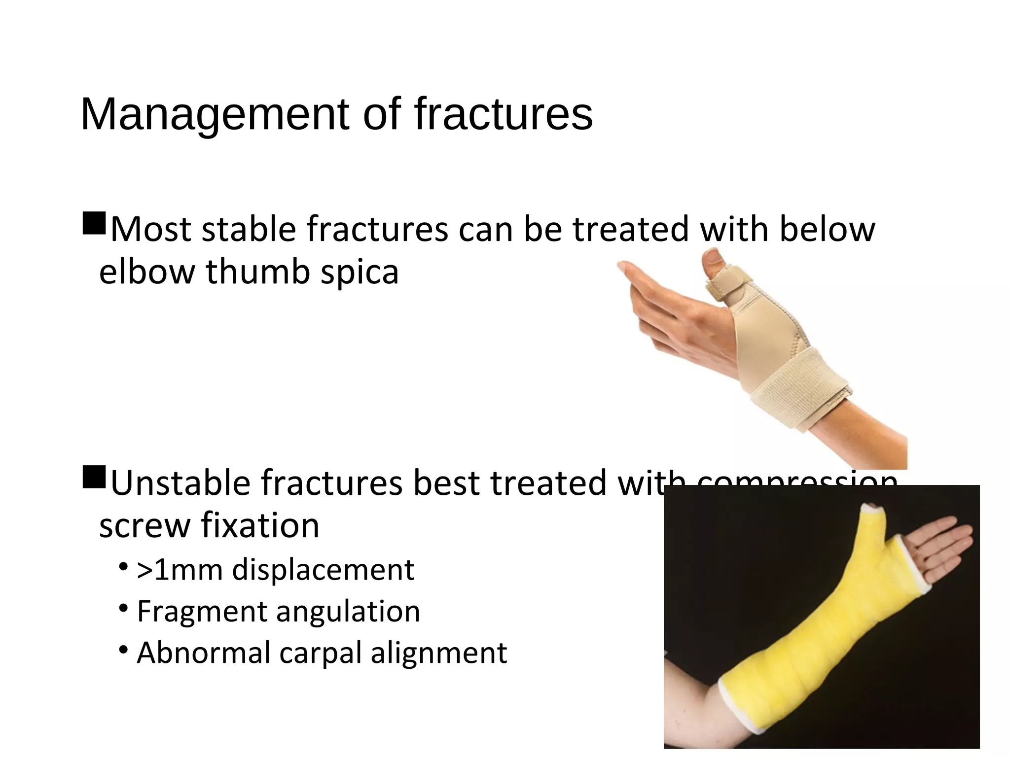 Management of fractures
Most stable fractures can be treated with below
elbow thumb spica
Unstable fractures best treated with compression
screw fixation
• >1mm displacement
• Fragment angulation
• Abnormal carpal alignment
 