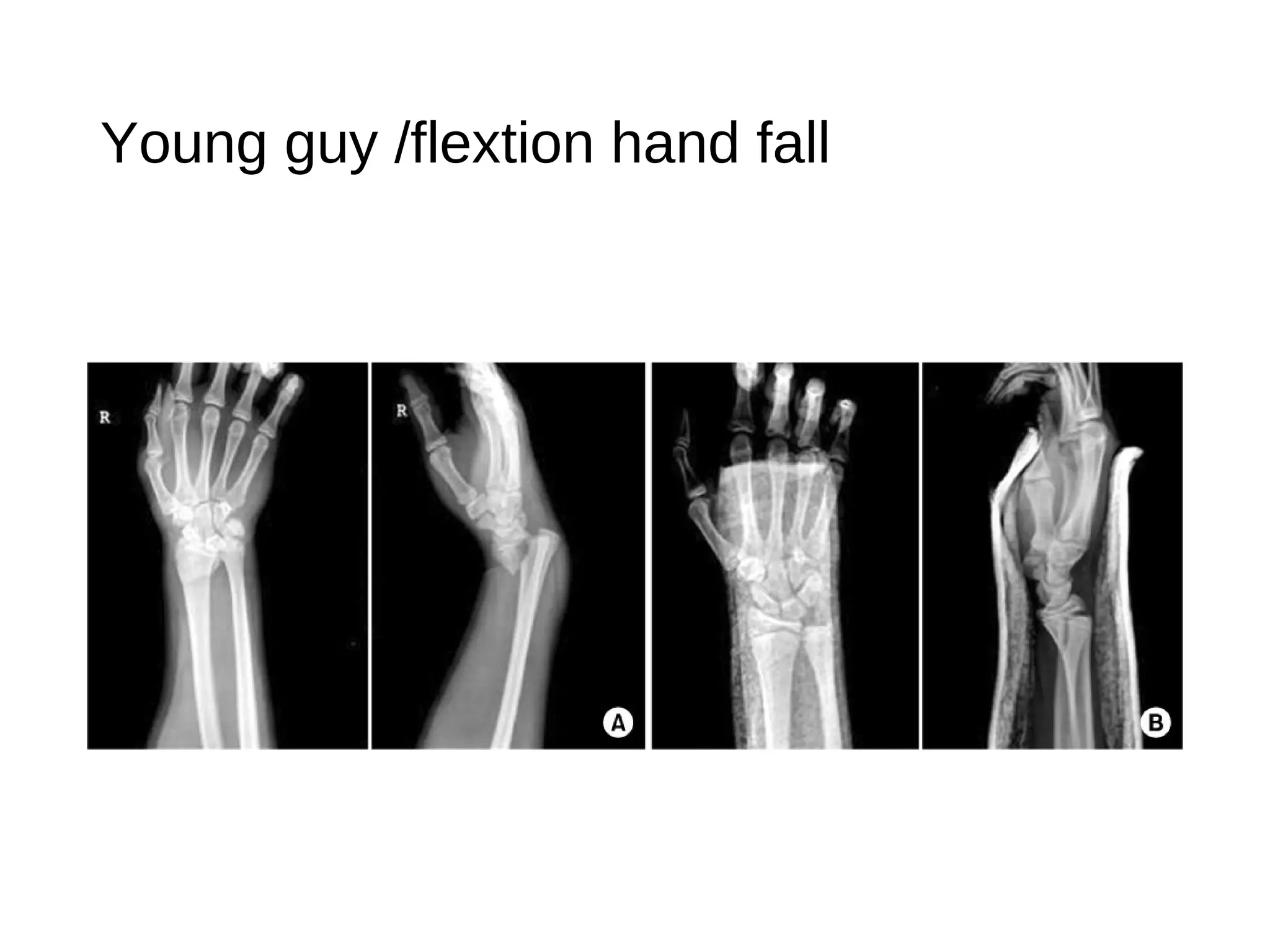 Young guy /flextion hand fall
 