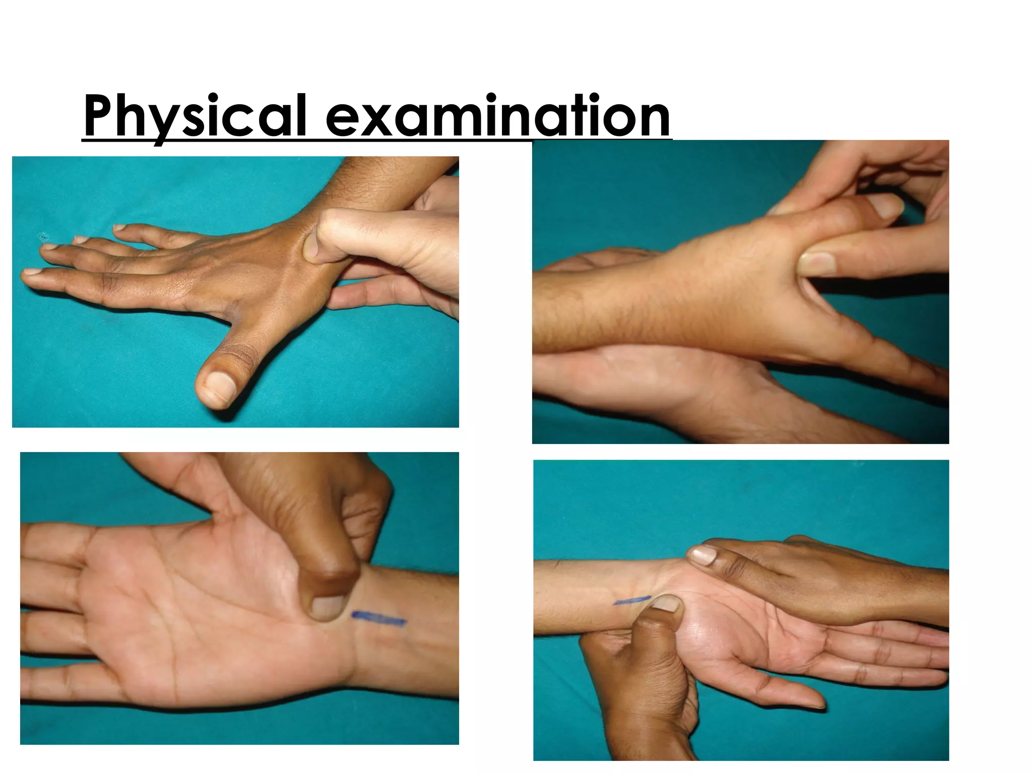 Physical examination
 