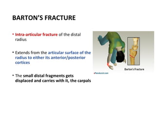 Barton Type distal radius & scaphoid fracture | PPT