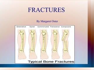 FRACTURES  By Margaret Oster 