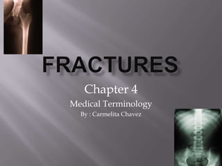 Fractures Chapter 4 Medical Terminology By : Carmelita Chavez 