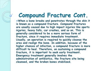 Comminuted Fracture