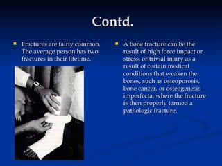 Contd. Fractures are fairly common. The average person has two fractures in their lifetime. A bone fracture can be the result of high force impact or stress, or trivial injury as a result of certain medical conditions that weaken the bones, such as osteoporosis, bone cancer, or osteogenesis imperfecta, where the fracture is then properly termed a pathologic fracture. 