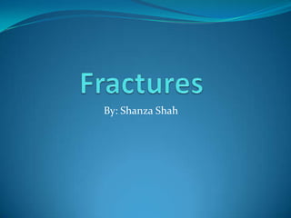 Fractures  By: Shanza Shah 