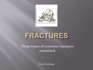 Three types of common fractures
           examined


          Zack Friedman
 