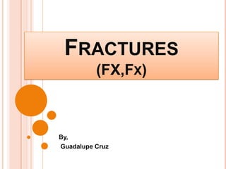 FRACTURES
(FX,FX)
By,
Guadalupe Cruz
 