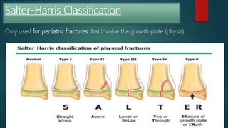 Fractures | PPTX