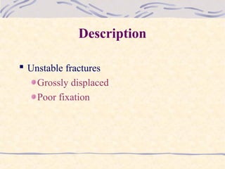 Description
 Unstable fractures
Grossly displaced
Poor fixation
 