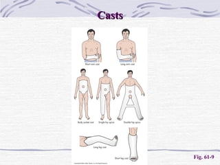 CastsCasts
Fig. 61-9
 