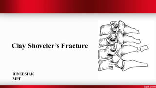 Clay Shoveler’s Fracture
RINEESH.K
MPT
 