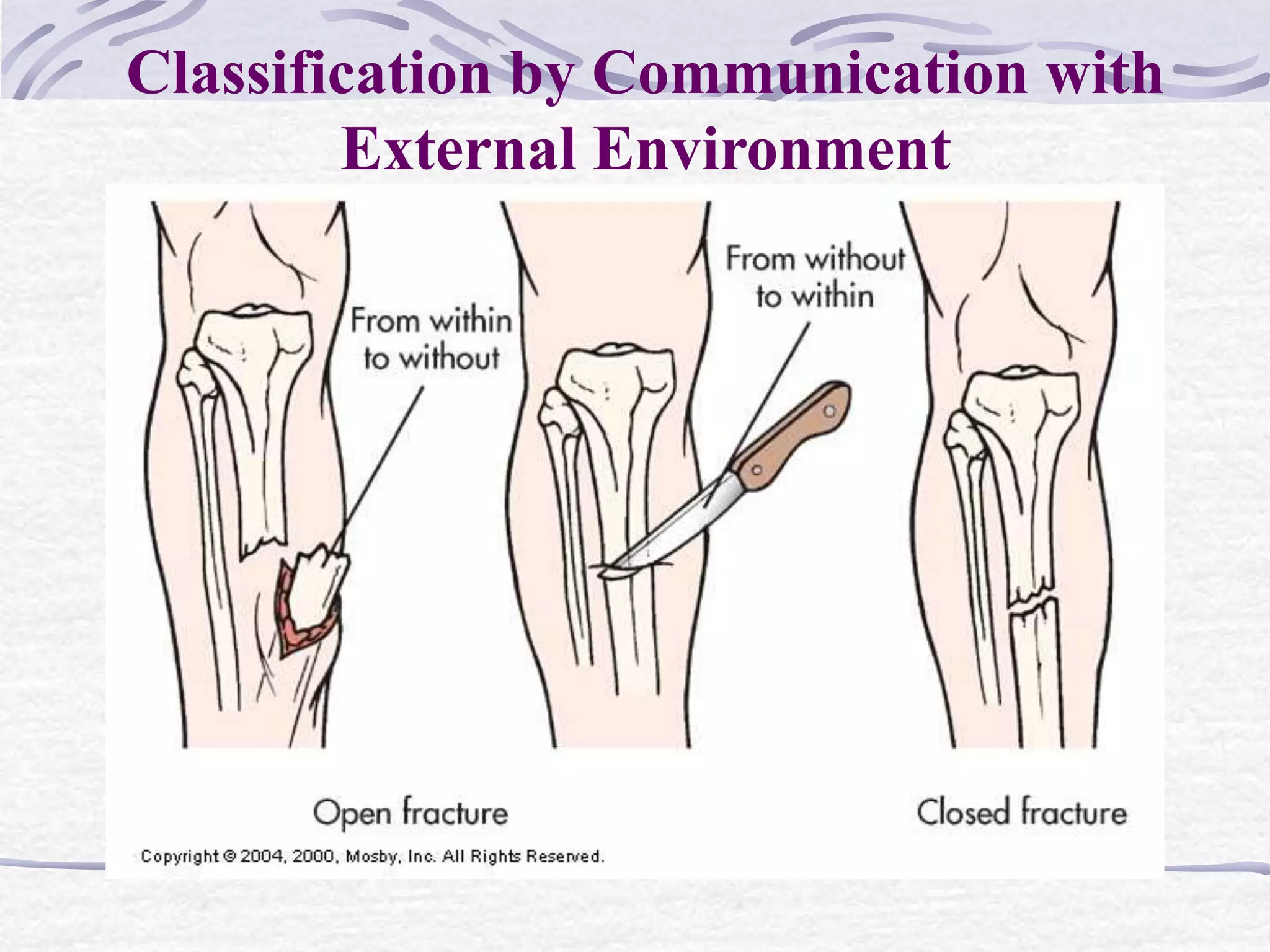 Classification by Communication with
External Environment
 