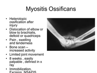 Myositis Ossificans
• Heterotopic
ossification after
injury
• Dislocation of elbow or
blow to brachialis,
deltoid or quadriceps
• Pain , swelling
and tenderness
• Bone scan –
increased activity
• Limited joint movement
• 8 weeks , easily
palpable , defined in x
ray
• Immobilization,
 