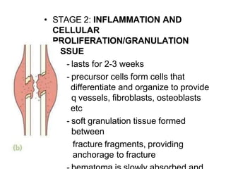 • STAGE 2: INFLAMMATION AND
CELLULAR
PROLIFERATION/GRANULATION
TISSUE
- lasts for 2-3 weeks
- precursor cells form cells that
differentiate and organize to provide
q vessels, fibroblasts, osteoblasts
etc
- soft granulation tissue formed
between
fracture fragments, providing
anchorage to fracture
 