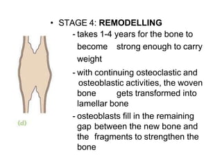 • STAGE 4: REMODELLING
- takes 1-4 years for the bone to
become strong enough to carry
weight
- with continuing osteoclastic and
osteoblastic activities, the woven
bone gets transformed into
lamellar bone
- osteoblasts fill in the remaining
gap between the new bone and
the fragments to strengthen the
bone
 
