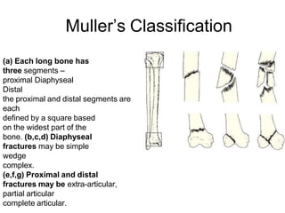 Muller’s Classification
(a) Each long bone has
three segments –
proximal Diaphyseal
Distal
the proximal and distal segments are
each
defined by a square based
on the widest part of the
bone. (b,c,d) Diaphyseal
fractures may be simple
wedge
complex.
(e,f,g) Proximal and distal
fractures may be extra-articular,
partial articular
complete articular.
 