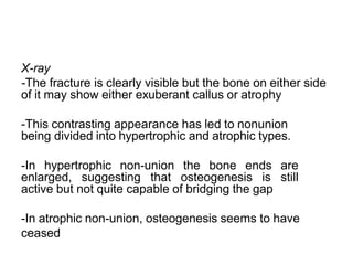X-ray
-The fracture is clearly visible but the bone on either side
of it may show either exuberant callus or atrophy
-This contrasting appearance has led to nonunion
being divided into hypertrophic and atrophic types.
-In hypertrophic non-union the bone ends are
enlarged, suggesting that osteogenesis is still
active but not quite capable of bridging the gap
-In atrophic non-union, osteogenesis seems to have
ceased
 