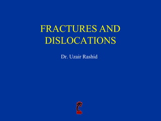 FRACTURES AND
DISLOCATIONS
Dr. Uzair Rashid
 