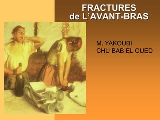 FRACTURES
de L’AVANT-BRAS
M. YAKOUBI
CHU BAB EL OUED
 