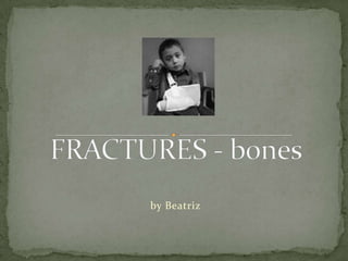 FRACTURES - bones by Beatriz  
