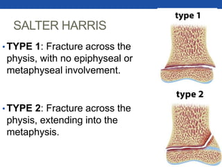 SALTER HARRIS
• TYPE 1: Fracture across the
physis, with no epiphyseal or
metaphyseal involvement.
• TYPE 2: Fracture across the
physis, extending into the
metaphysis.
 